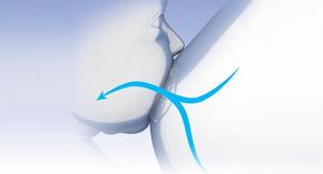 Protetores de seios Silicone - Chicco